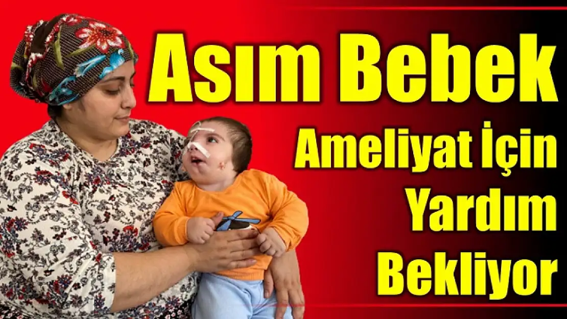 Asım bebek ameliyat olabilirse sağlığına kavuşacak