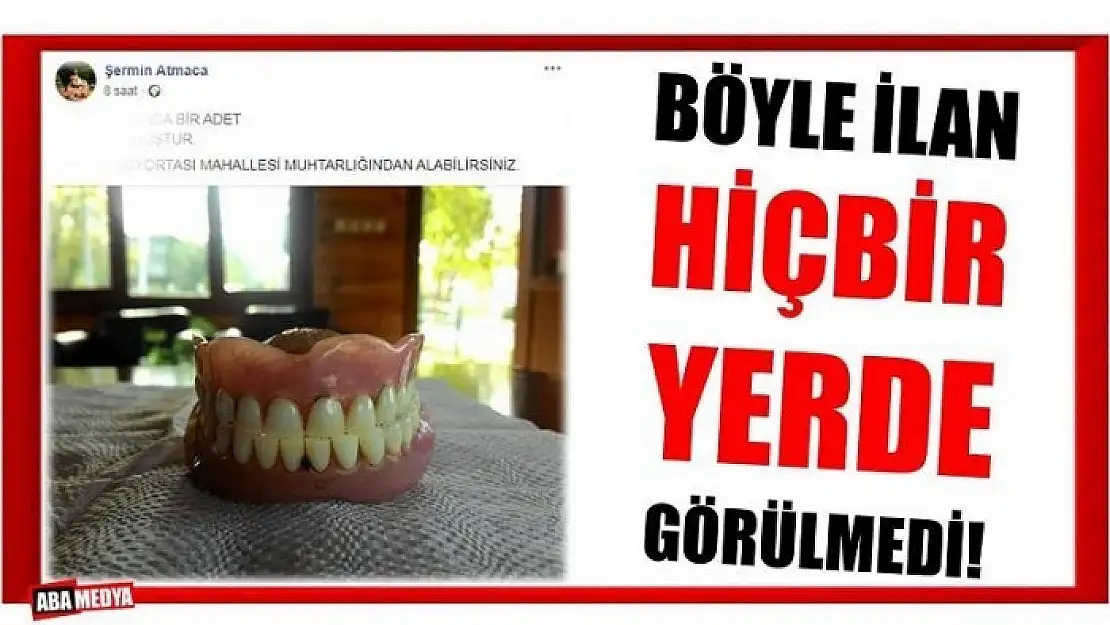 BU DİŞLER SAHİBİNİ SOSYAL MEDYADA ARIYOR!