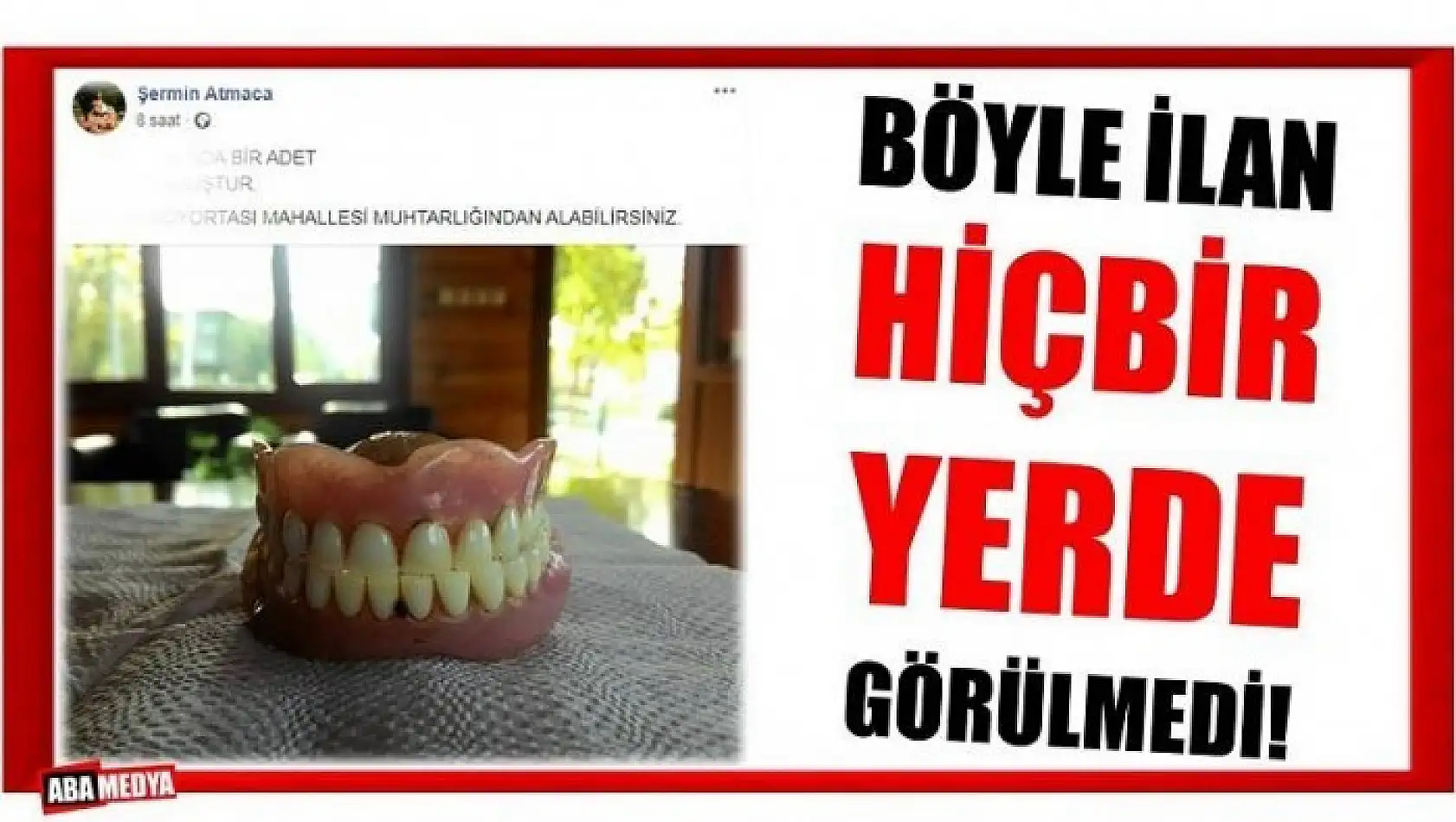 BU DİŞLER SAHİBİNİ SOSYAL MEDYADA ARIYOR!