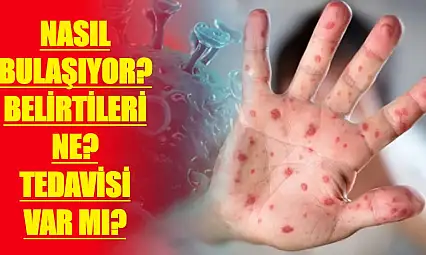 Bakanlıktan Maymun Çiçeği rehberi