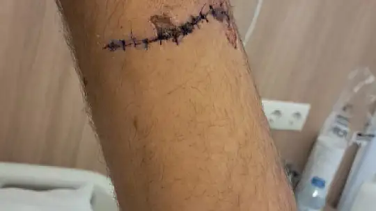 Ayının saldırısına uğrayan çiftçi dehşet anlarını anlattı: