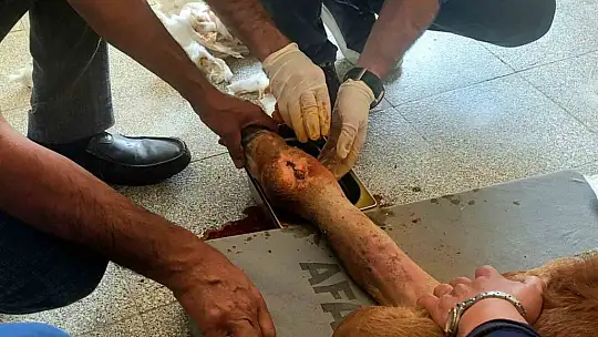 Doğum sırasında bacağı kırılan buzağı, başarılı ameliyatla hayata tutundu