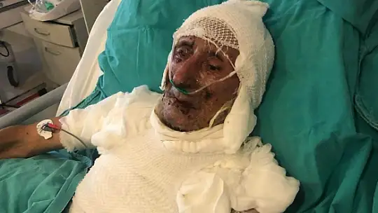 Kardeşini ahıra kilitleyip ateşe verdiği iddia edilen şahıs için 21 yıla kadar hapis cezası talebi