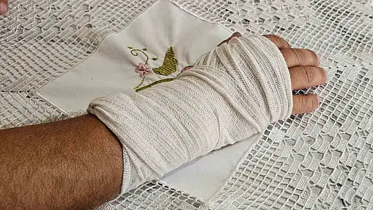 Sokak köpeğinin saldırısına uğradı, ayağı iki yerden kırıldı