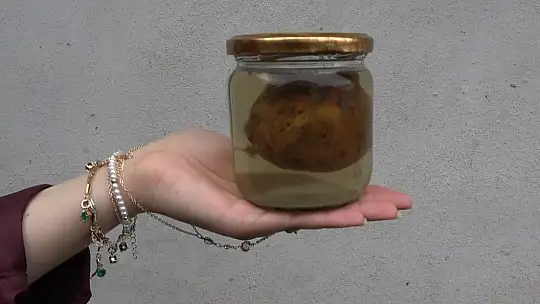 Yemek borusuna armut kaçan gebe inek, ameliyatla kurtarıldı