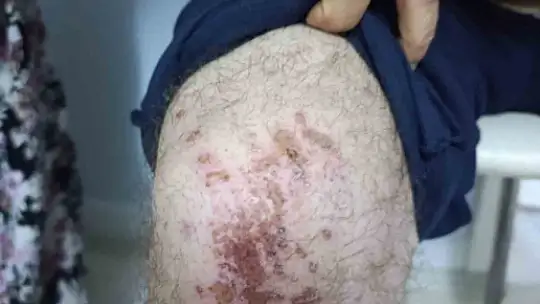 Yüzde 90 engelli vatandaş acımasızca darp edildi