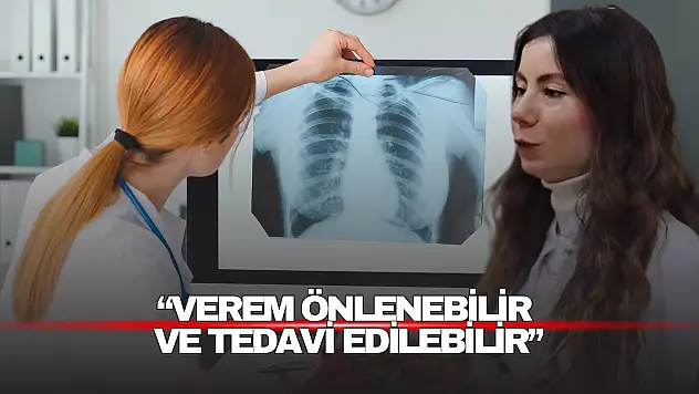 Bartın İl Sağlık Müdürlüğü'nden tüberküloz uyarısı
