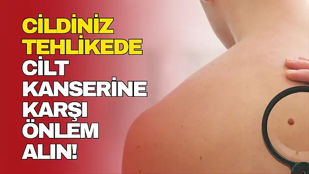 Cildiniz Tehlikede: Cilt Kanserine Karşı Önlem Alın!