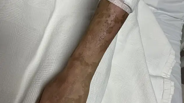 Lavabo açıcı bomba gibi patladı