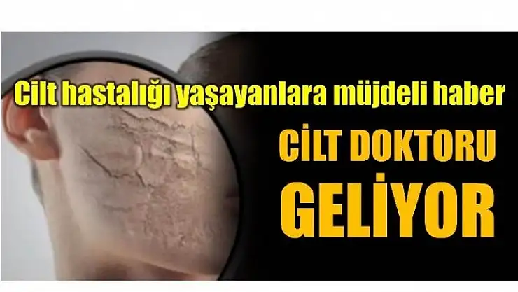 BEKLENEN CİLDİYECİ GELİYOR…