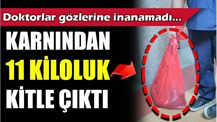 KARNINDAN 11 KİLOLUK KİTLE ÇIKTI