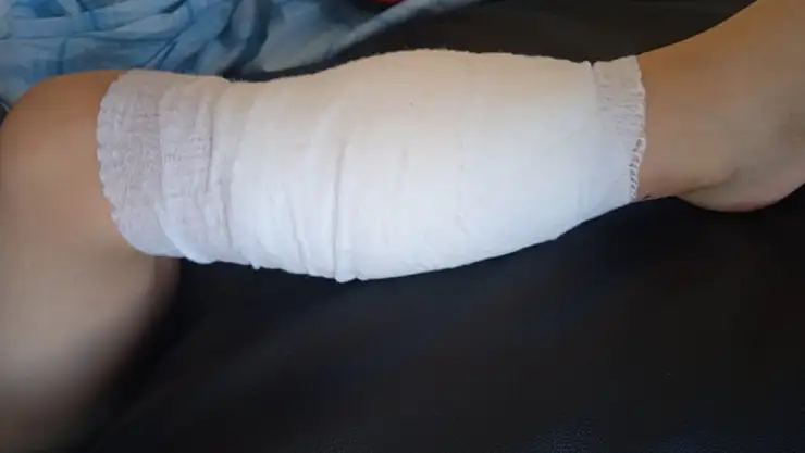 Pitpull cinsi köpeğin saldırdığı 5 yaşındaki çocuk hastanelik oldu