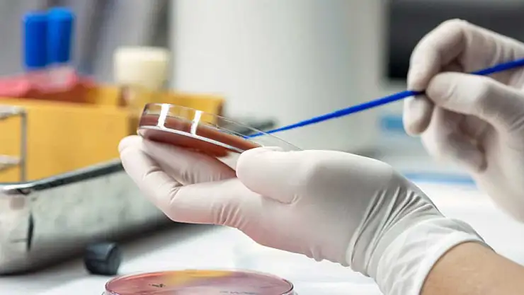 Sağlık Müdürlüğü Sepsis Hastalığına dikkat çekti