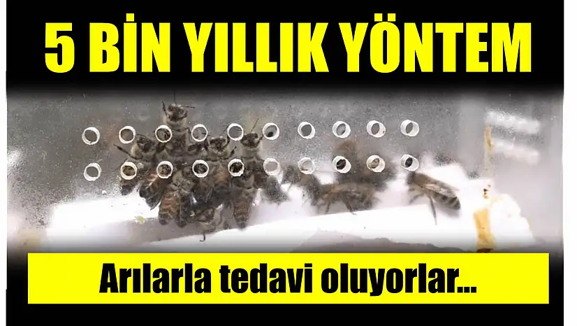 Romatizma ve bel ağrısı olanlar dikkat
