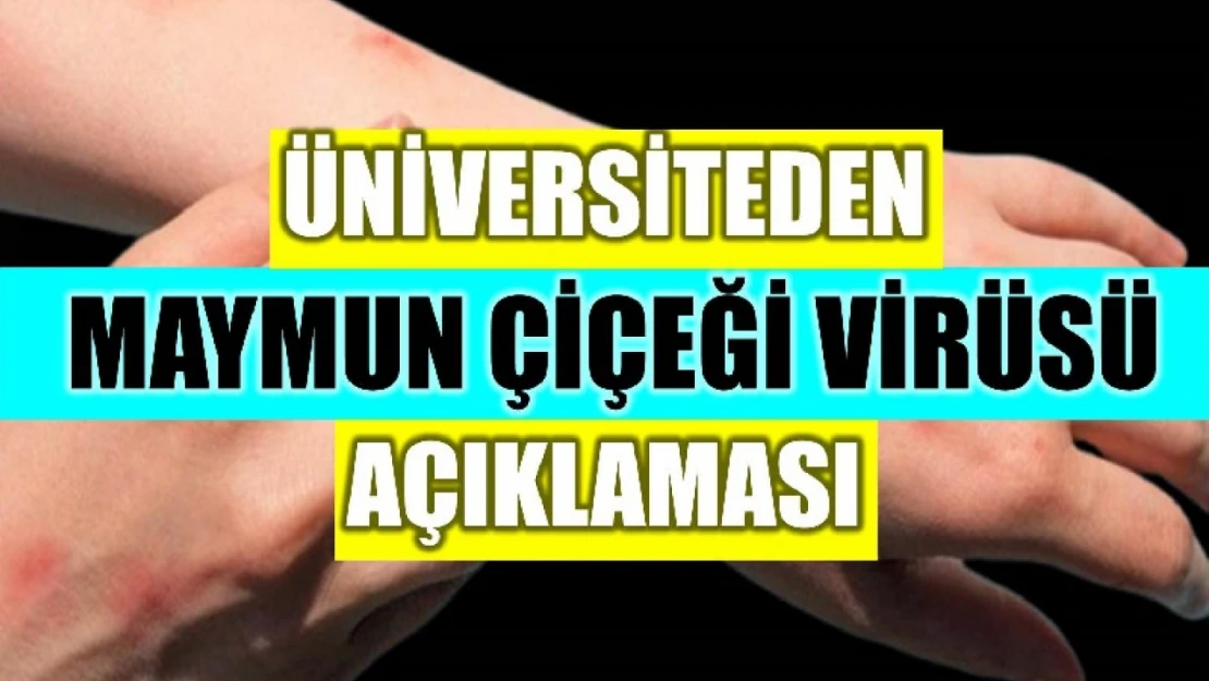 Uluslararası öğrencilerle ilgili açıklama