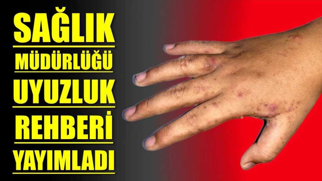 Uyuzluk vakaları artıyor