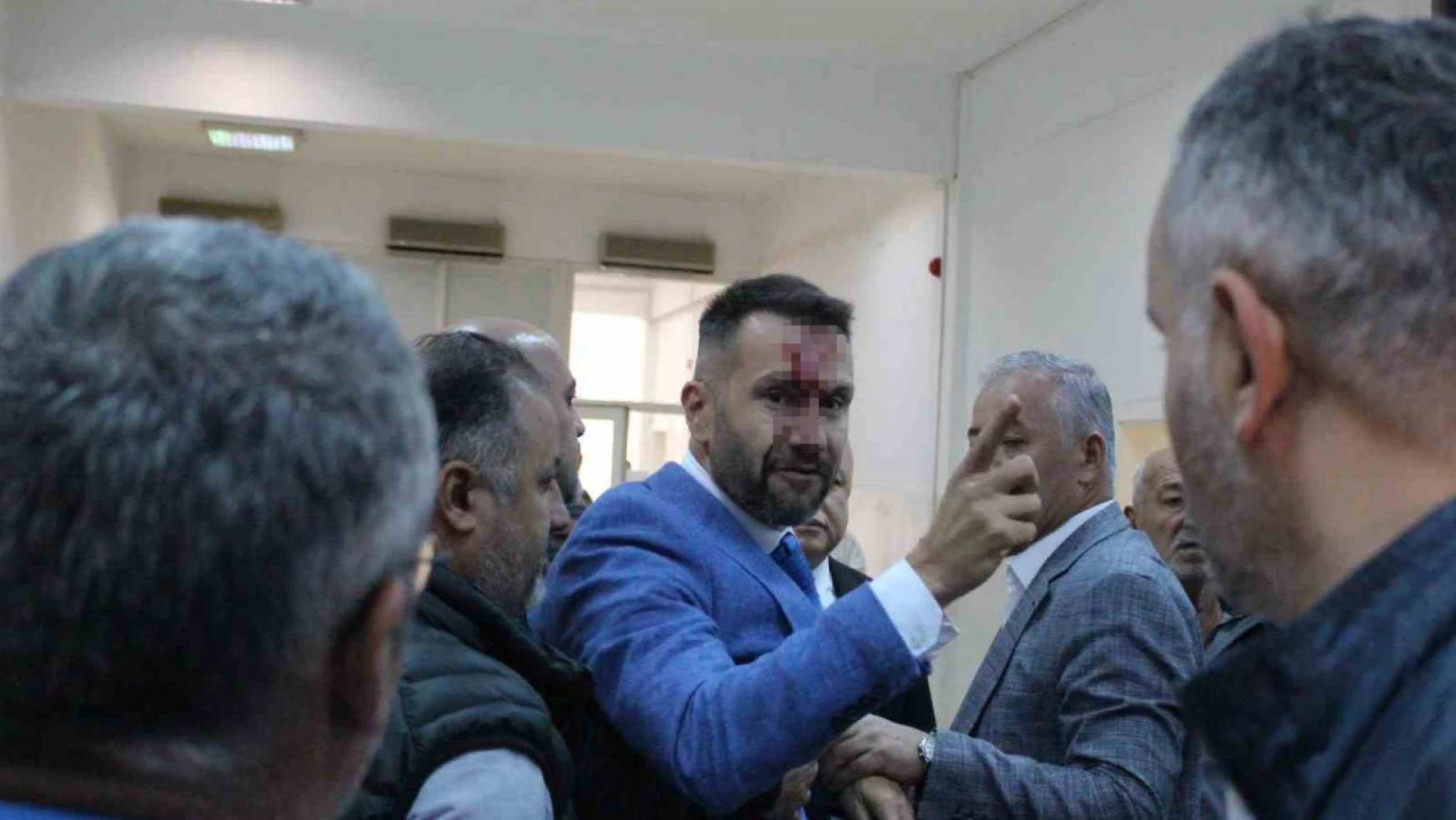 Belediye meclisinde kavga çıktı, meclis üyesinin burnu kırıldı