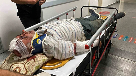Tıra arkadan çarpan otomobilin tavanı koptu: 1 ağır yaralı